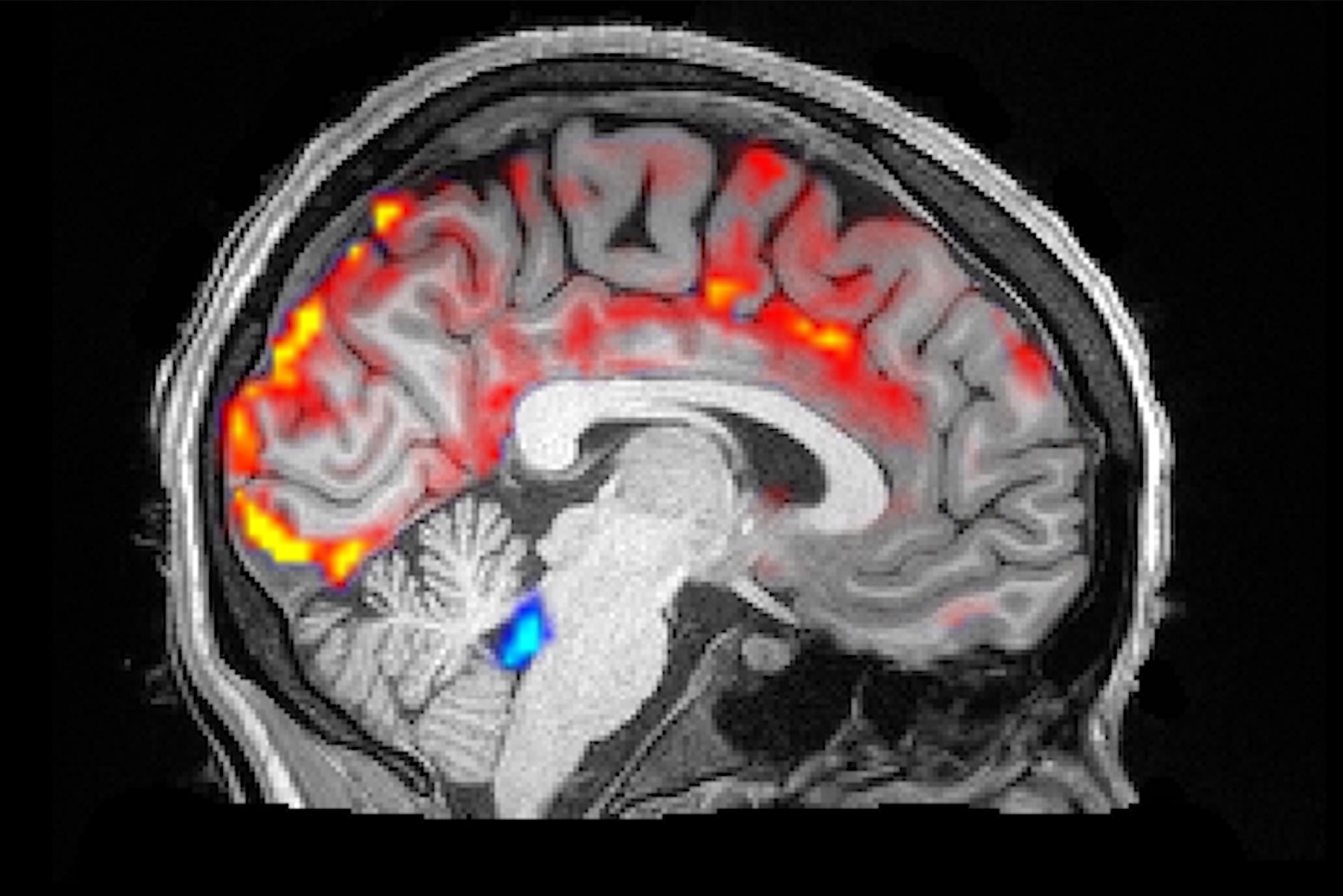 Cerebrospinal Fluid "Brain Washing" During Sleep | The Brink