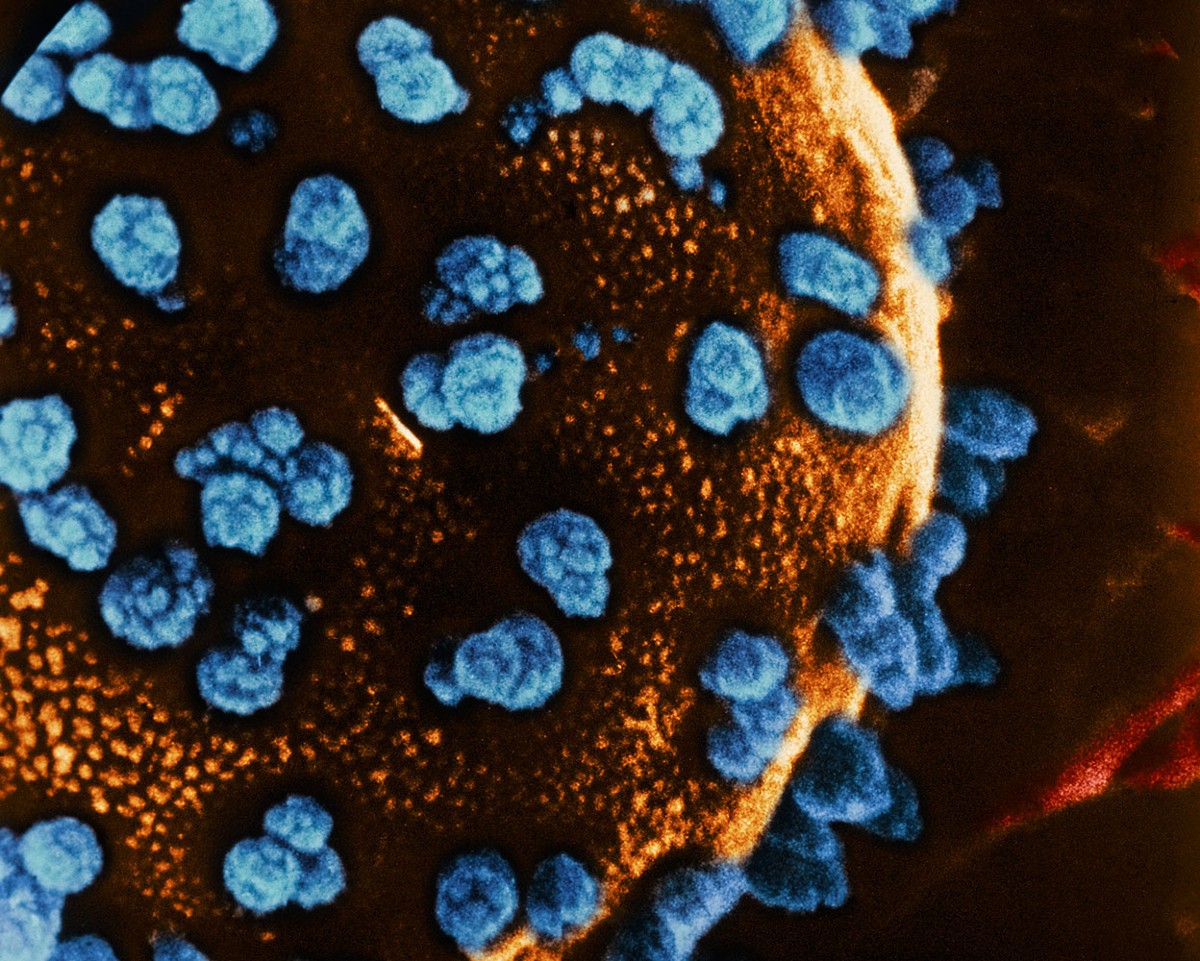 Stem cells reverse woman's diabetes