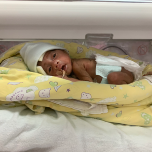 EP01-800克的重量：从三次急诊到紧急生产