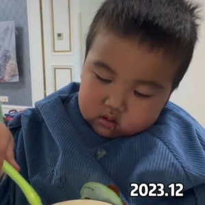 小朋友生病一年的变化：最近看的最揪心的一个视频