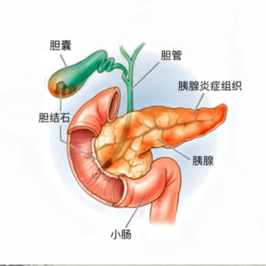 身体里的灭霸——狠起来连自己都打你敢信？《当代青年自救指南（疯狂的胰腺）》