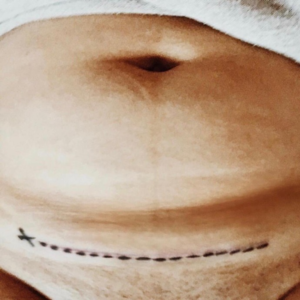 聊聊运动和不运动身体的变化