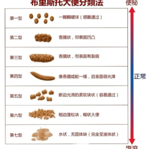 047：姐妹聊天室（慎入-超重口）：解锁肠胃不适的种种问题与解决方案|女女闲聊